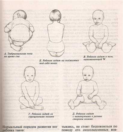 Почему малыш не сидит. Этапы ползания ребенка. Во сколько месяцев ребёнок должен сидеть самостоятельно. В каком возрасте дети начинают сидеть самостоятельно. Как понять чттреюенок сидит.