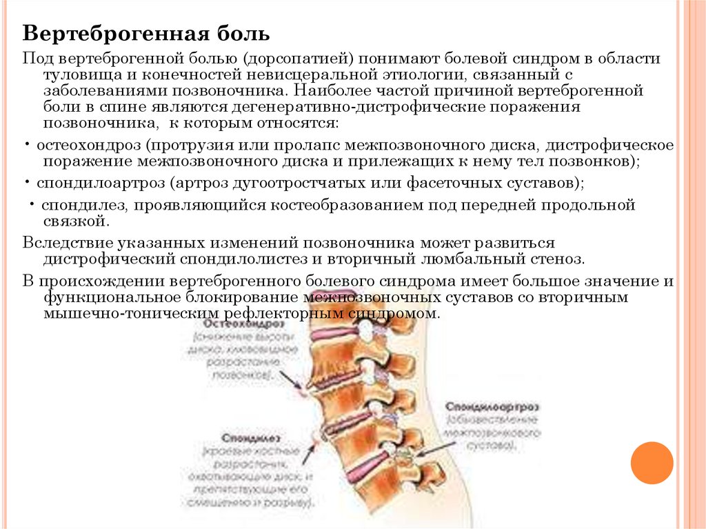 Схема лечения остеохондроза