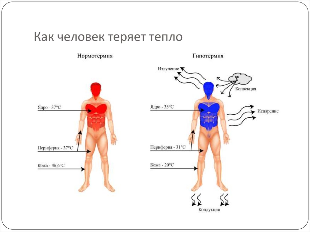 Карта вызова гипотермия