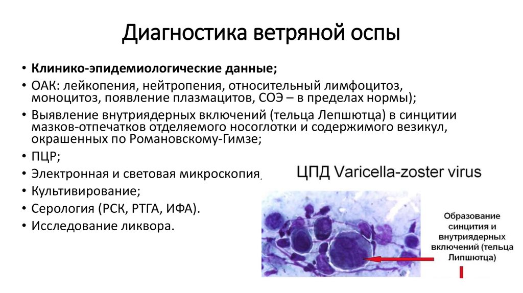 Карта вызова ветряная оспа у взрослого