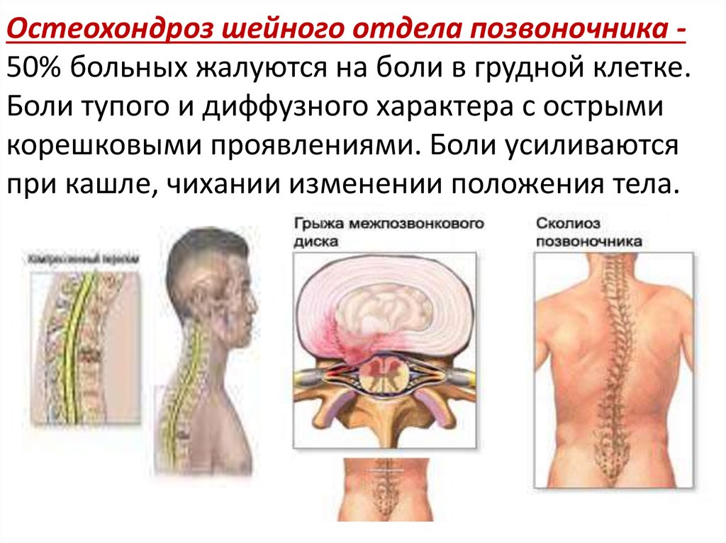 Остеохондроз грудного отдела позвоночника карта вызова скорой помощи шпаргалка