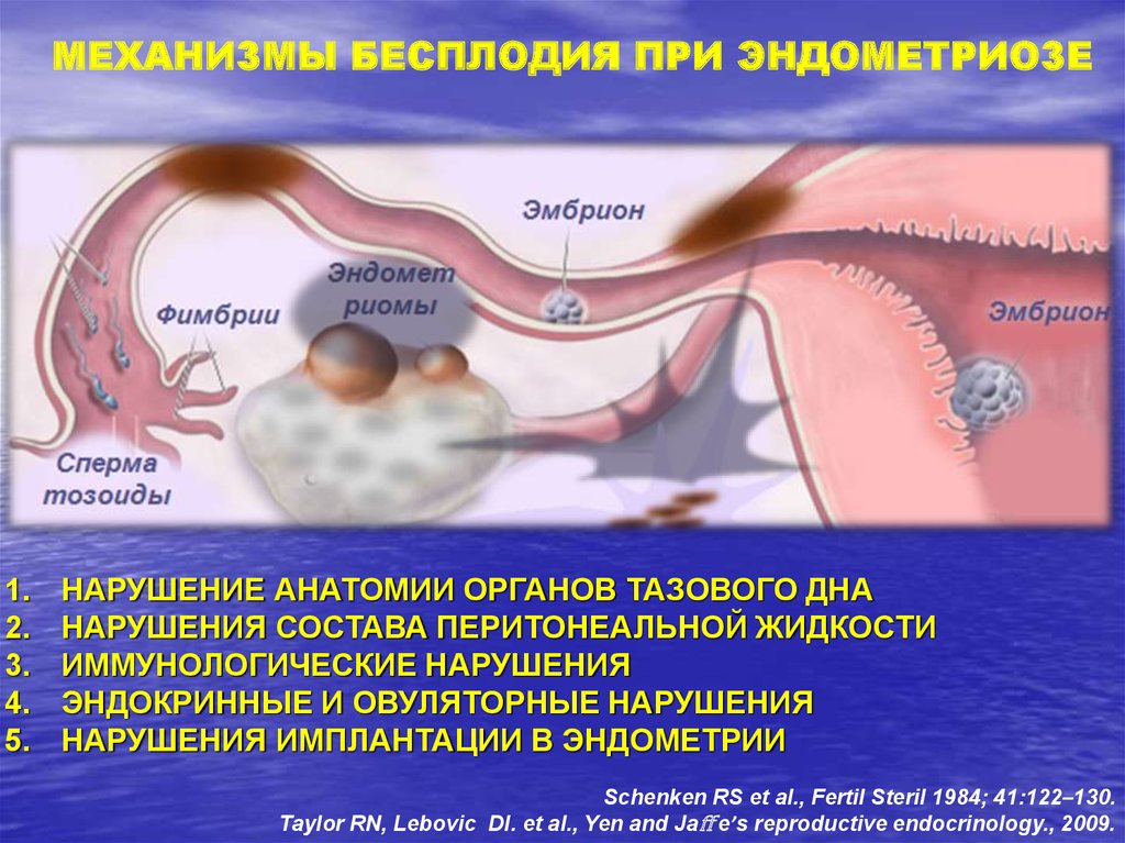 Эндометриоз матки как лечить после 40 лет. Эндометриоз источник инфекции. Эндометриоз презентация. Эндометриоз факторы риска.