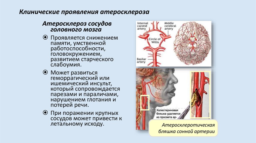 Деменция карта вызова