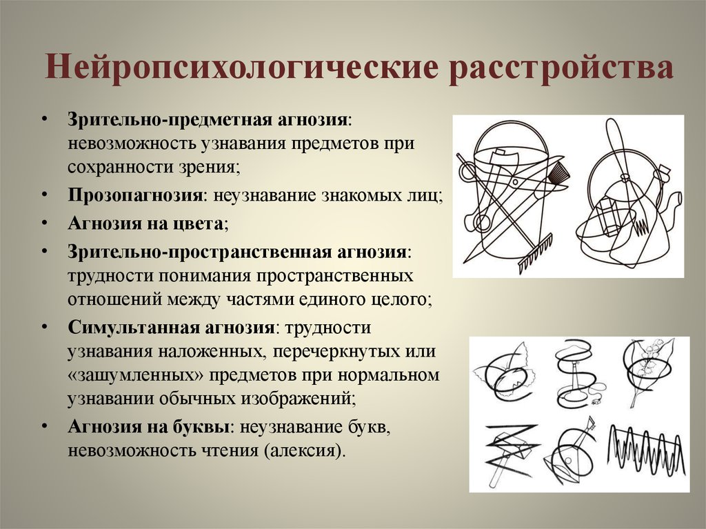 Вид агнозии характеризующийся нарушением узнавания предметов или их изображений