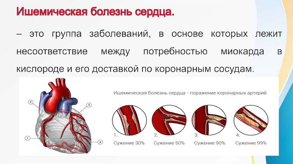 Укрепление сосудов