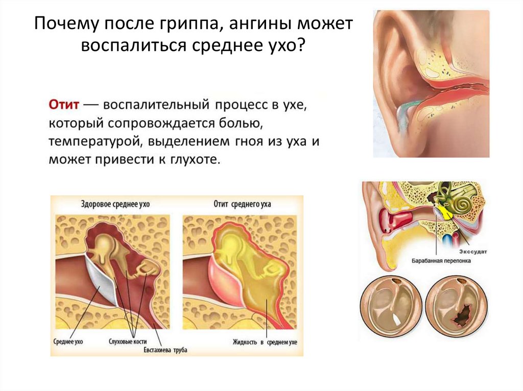 Заложило ухо и не проходит