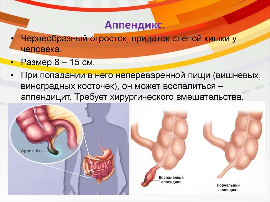 Лечение аппендицита без операции антибиотиками схема