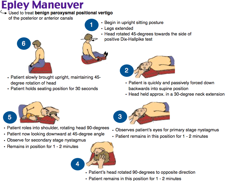 Прием эпле. Маневры Эппле при головокружении. Манёвр Эпли от головокружения. Вестибулярная гимнастика метод Эппле. Вестибулярная гимнастика маневр Эпли.