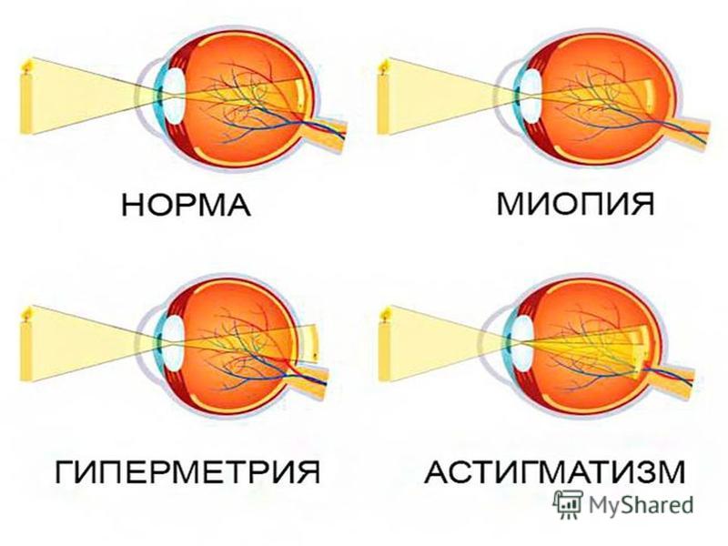 Точка зрения именно какая. Способы улучшения зрения доклад по физкультуре. Способы улучшения зрения презентация по физкультуре. Способы улучшения зрения реферат по физкультуре. Доклад по физре на тему способы улучшения зрения.