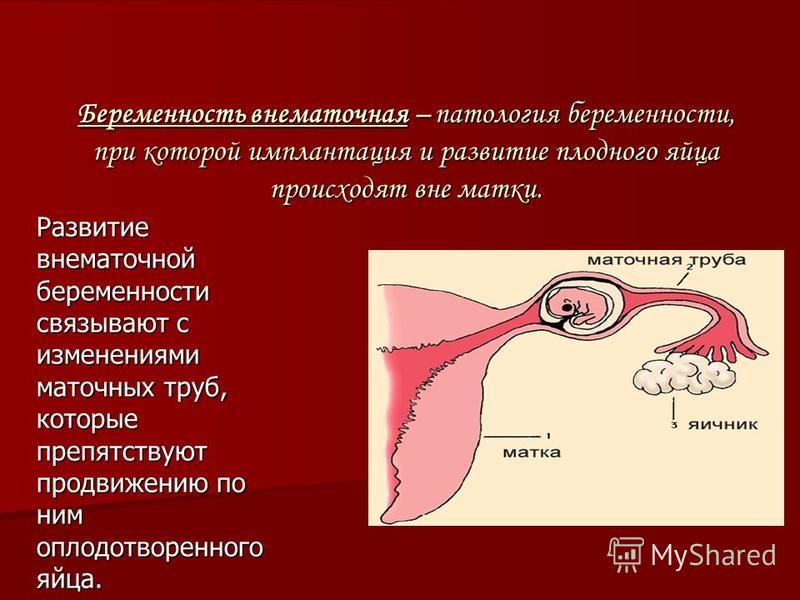 Развивающаяся внематочная беременность. Внематочная беременность разрыв маточной трубы. Резекция маточной трубы при внематочной беременности. Внематочная беременность Трубная ампулярную. Внематочная (эктопическая) беременность.