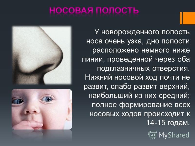 Какой нос будет у ребенка. Носовые ходы у новорожденного. Носовые ходы у грудничков. Узкие носовые ходы у новорожденного. Узкие носовые ходы у грудничка.