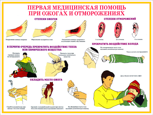 Помощь при обморожении фото