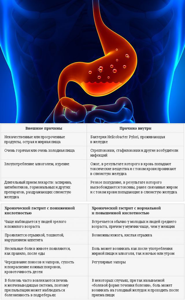 Боли в желудке после тортов