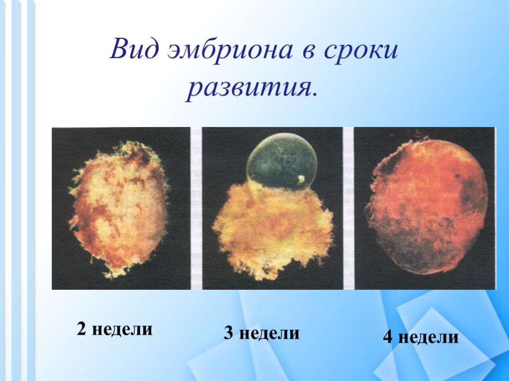 Картинки 4 недели беременности