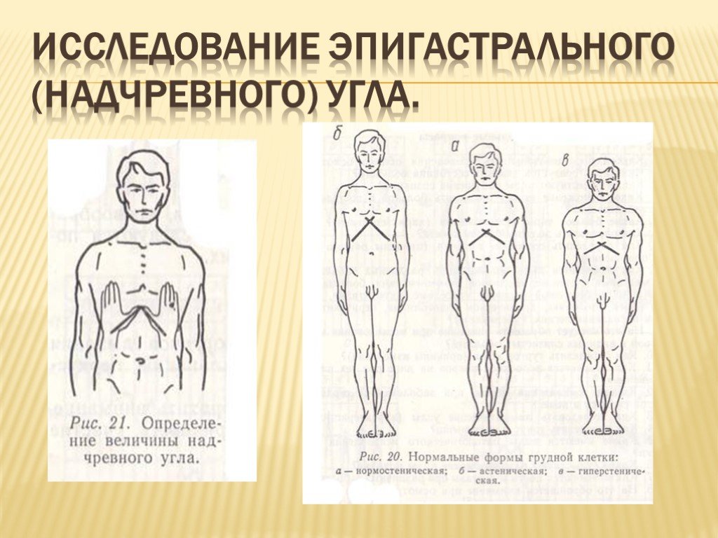 Для описания женских типов телосложения наиболее приемлема схема