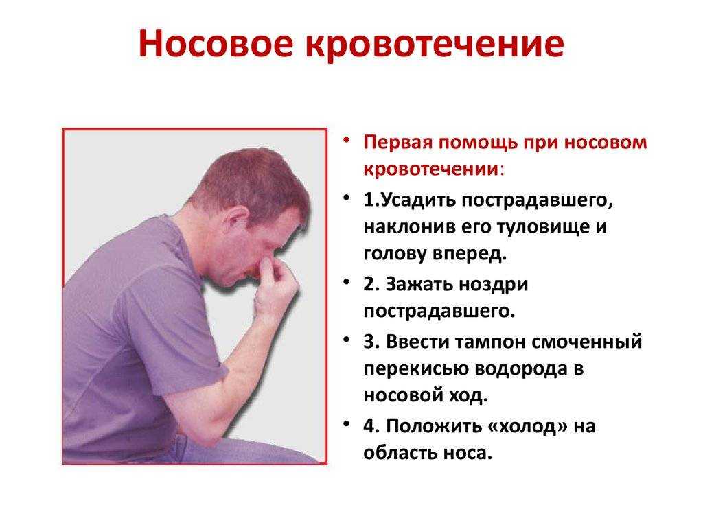 Карта скорой помощи носовое кровотечение