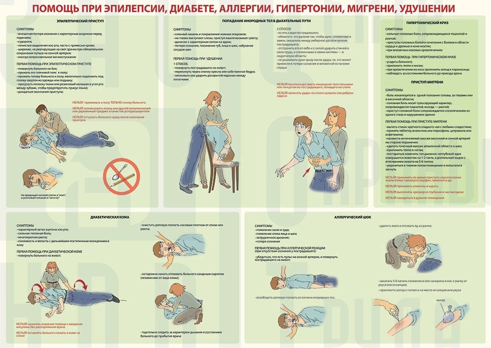 Помощь при эпилепсии картинки