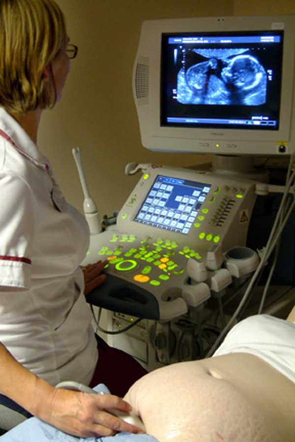 Допплерография ребенку. УЗИ С доплером при беременности. УЗИ доплер 3 триместр. УЗИ по беременности с доплером что это.