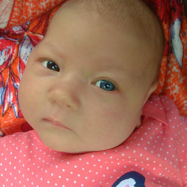 Может ли у ребенка поменяться. Цвет глаз у новорожденных. Цает глаза новорожденного. Разный цвет глаз у новорожденных. Разный цвет глаз у грудничка.