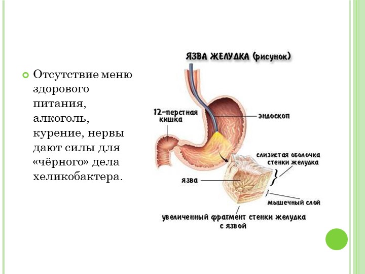 Меню при 12 перстной кишки. Язвенная болезнь желудка и двенадцатиперстной кишки. Курение и язвенная болезнь. Язва желудка от курения.