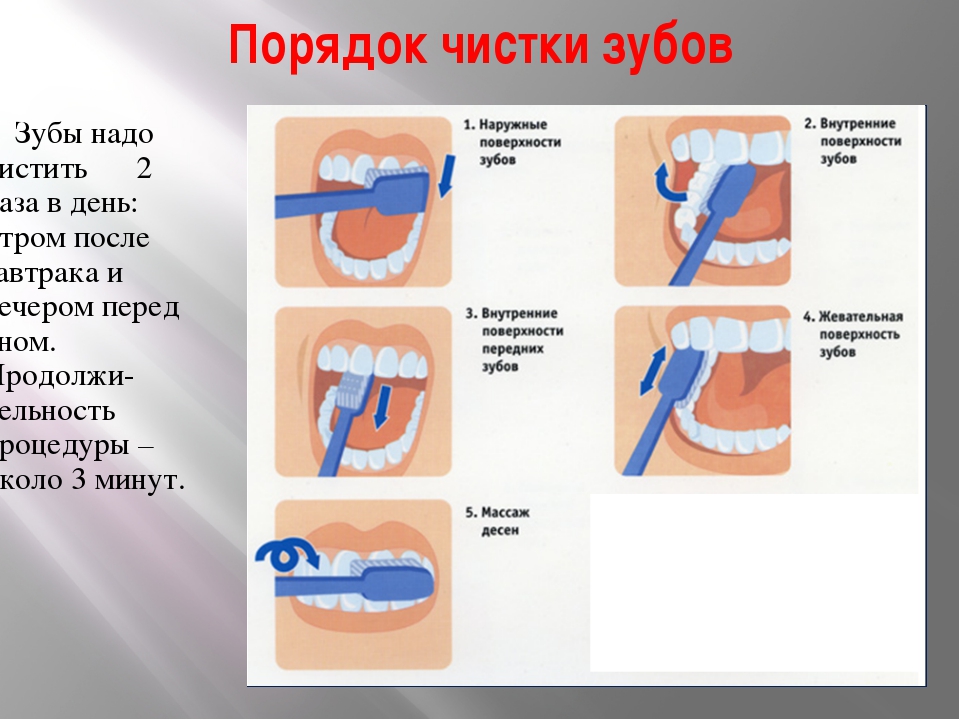 Чистка зубов после лечения. Правильная техника чистки зубов. Правильная чистка зубов для детей. Гигиена зубов и полости рта.