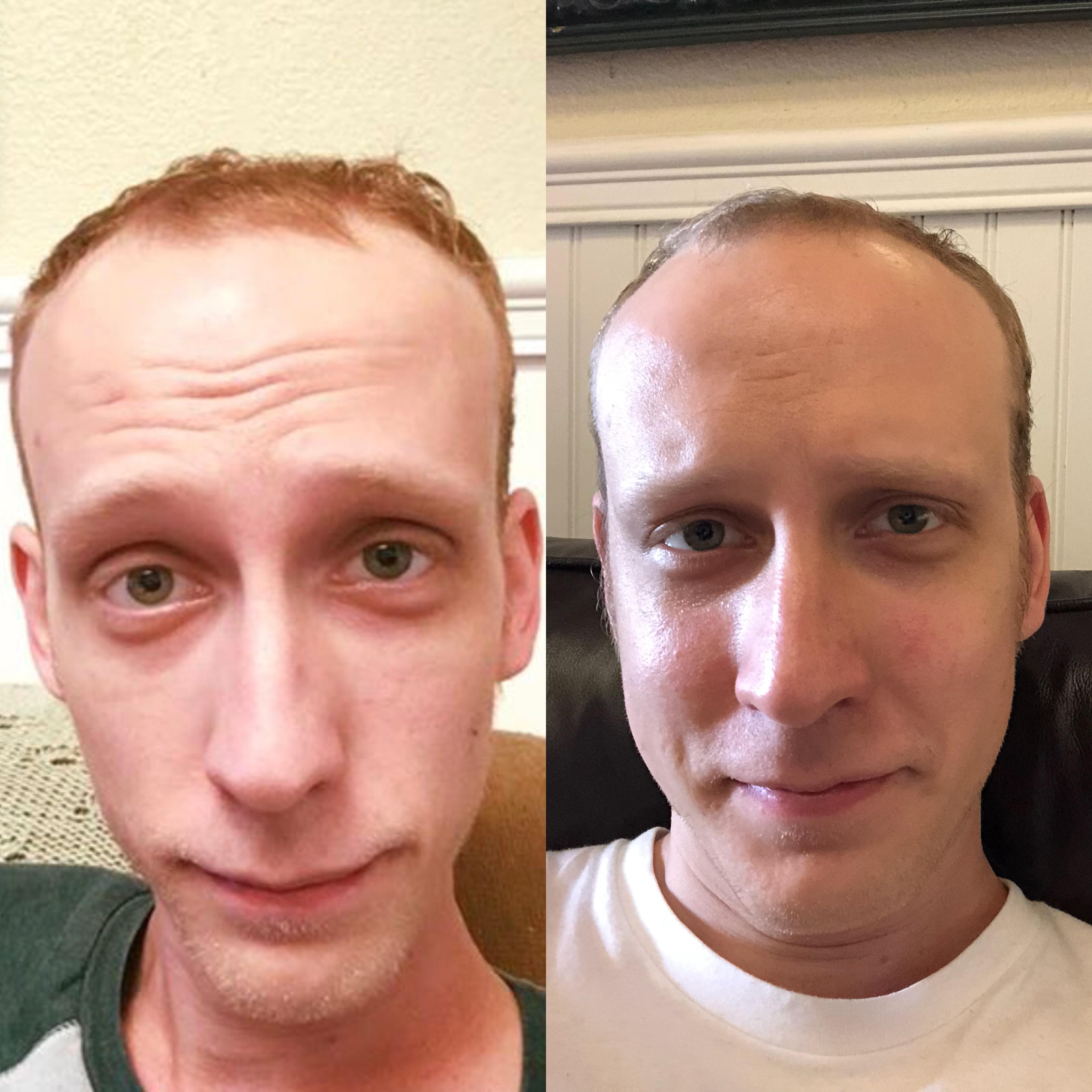 Сайт изменения лица. Лицо курильщика до и после. Бросил курить дл после. Изменение лица от алкоголизма.