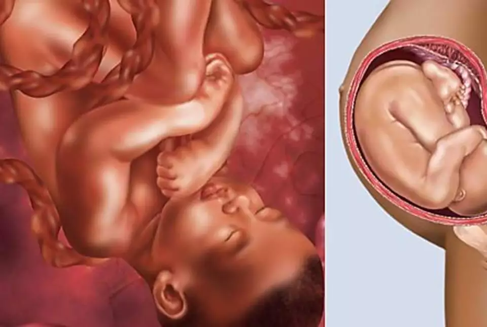 Jenjibre embarazo