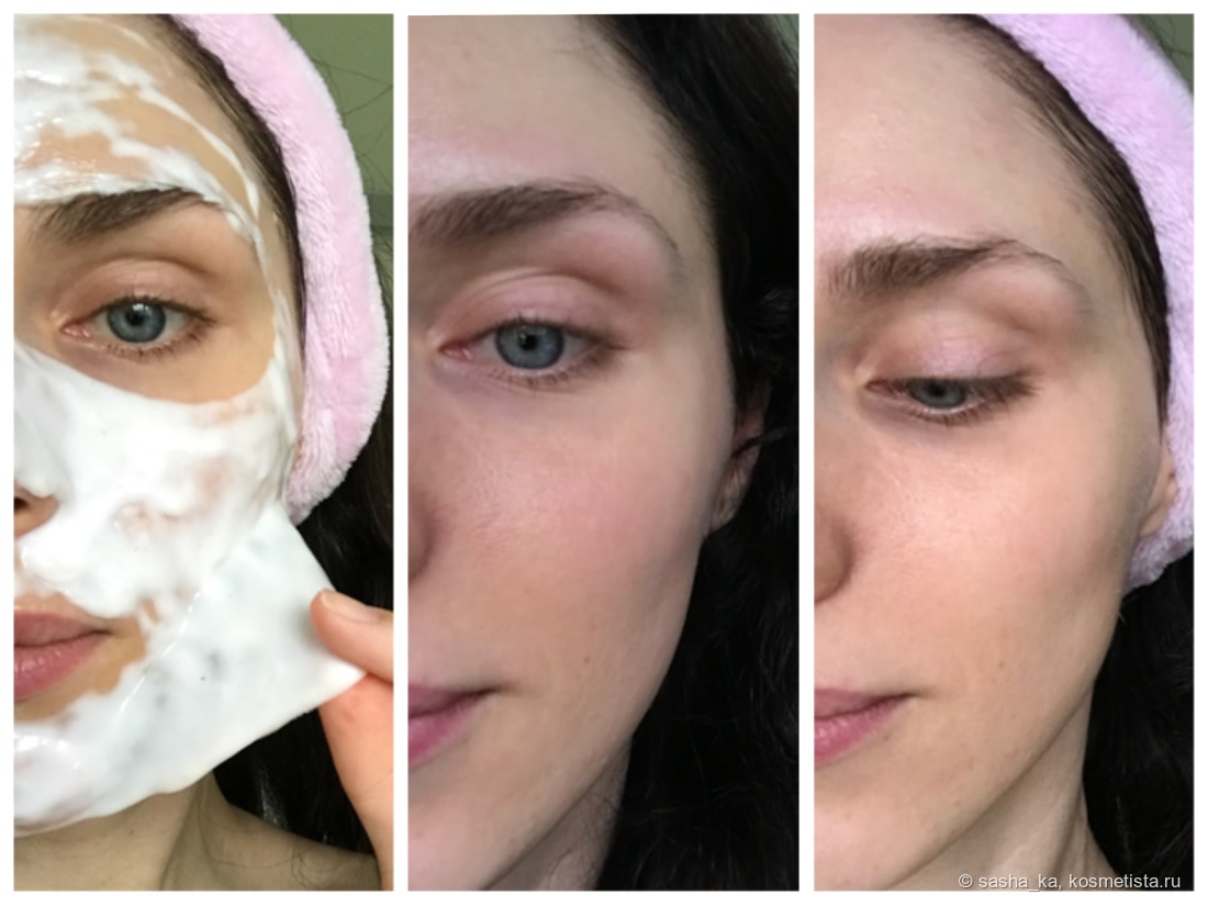 Альгинатная маска до и после. Альгинатные маски эффект до и после. Альгинатная маска для лица. Альгинатные маски для лица до и после.