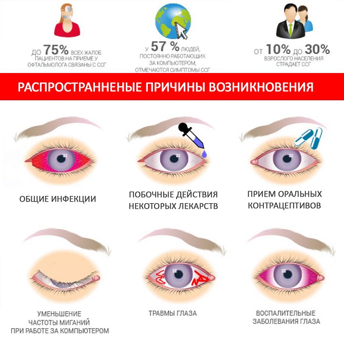 К чему слезится левый глаз. Причины возникновения синдрома сухого глаза. Синдром сухого глаза симптомы.