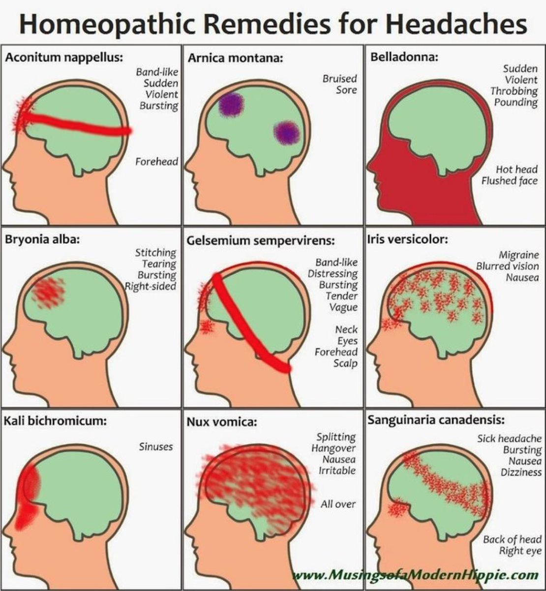 Температура боль в затылке. Схема локализации головной боли напряжения. Типы головной боли. Головная боль локализация. Боль в голове.