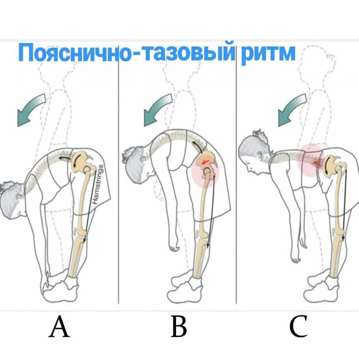 Где находится тазобедренный сустав у женщин фото и где ощущение боли в правом боку