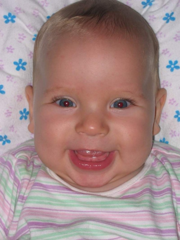 Верхние зубы у детей до года фото