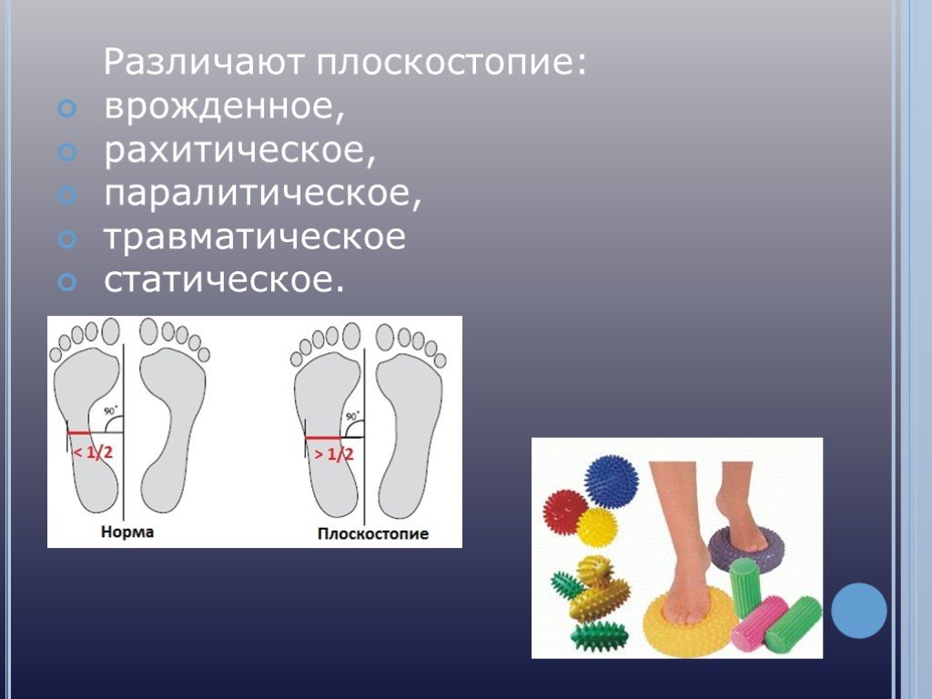 Плоскостопие картинка для детей