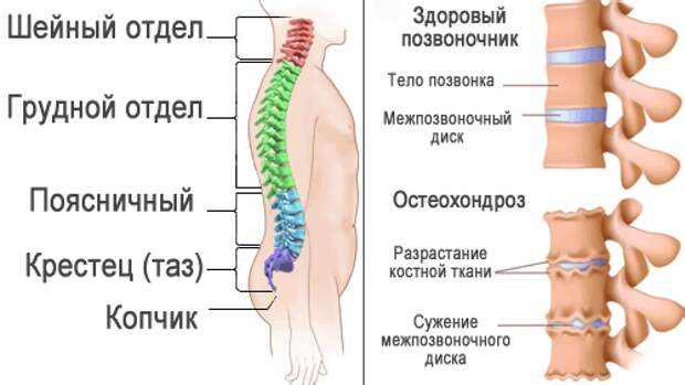 Карта смп дорсалгия грудного отдела позвоночника