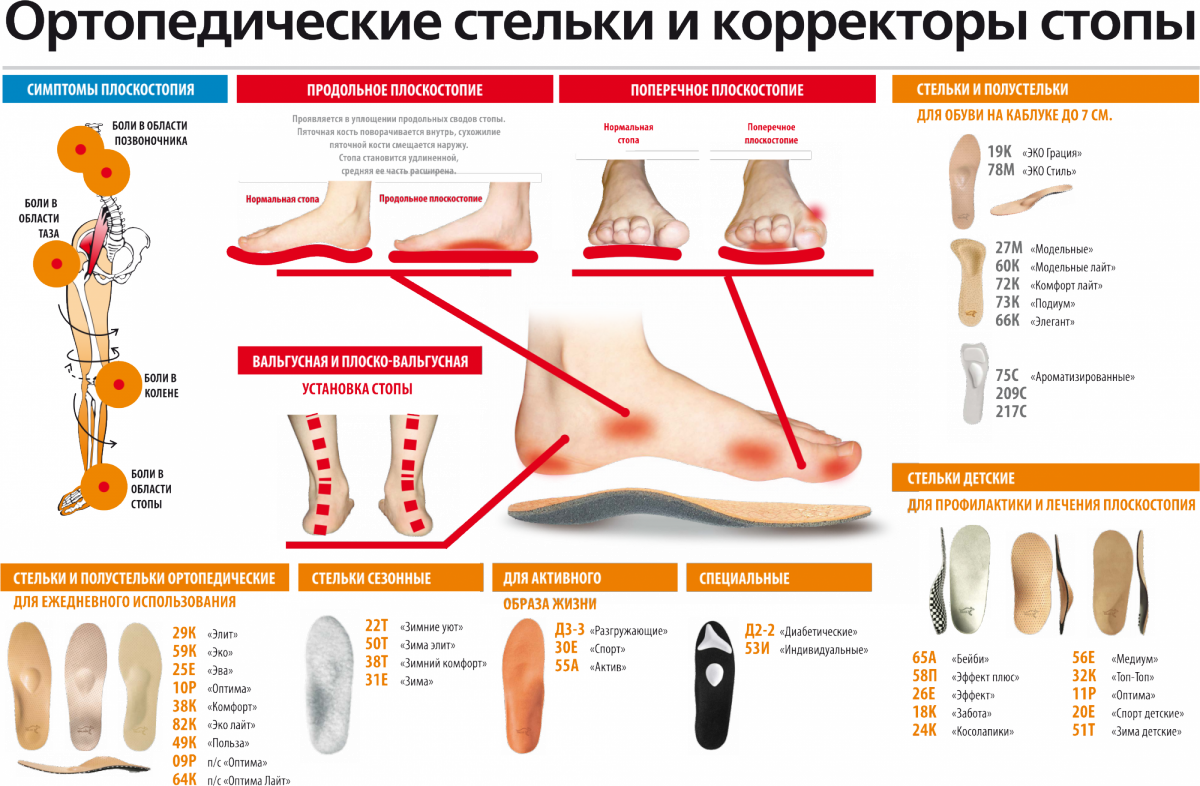 Стопы какой врач. Поперечное плоскостопие симптомы стельки. Как правильно выбрать размер стельки для обуви ортопедические. Ортопед продольное плоскостопие. Стельки при плоскостопии 1 и 2 степени.