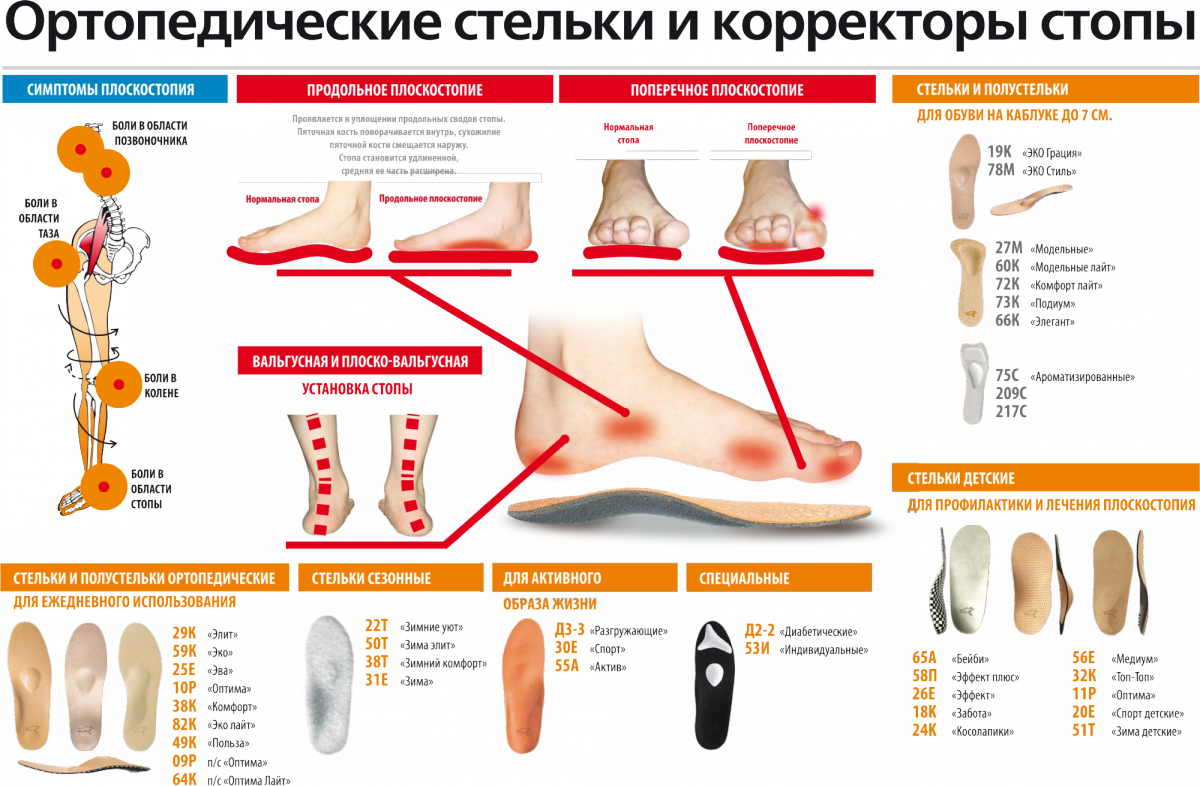 Ортопед стопа. Поперечное плоскостопие симптомы стельки. Как правильно выбрать размер стельки для обуви ортопедические. Ортопед продольное плоскостопие. Стельки при плоскостопии 1 и 2 степени.