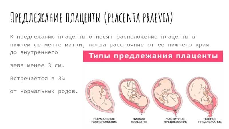 Зев закрыт при беременности. Плацента 20 мм от внутреннего зева. Нижний край плаценты от внутреннего зева норма. Нижний край плаценты норма 20 недель. Расположение от края плаценты.до.внутреннего.зева 30 мм.