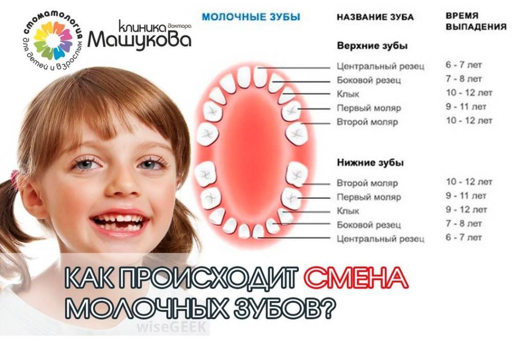 Какой первый зуб выпадает у ребенка. Схема выпадения молочных зубов. Какие зубы выпадают у детей. Схема выпадения зубов у детей. Выпадают молочные зубы у ребенка.