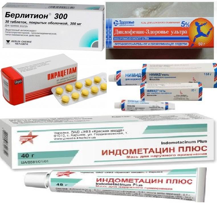 Шейный остеохондроз медикаментозное. Лекарство при остеохондрозе поясничного отдела уколы. Препараты при остеохондрозе поясничного отдела таблетки. Остеохондроз поясничного отдела таблетки обезболивающие. Лекарство от хондроза поясничного отдела уколы.