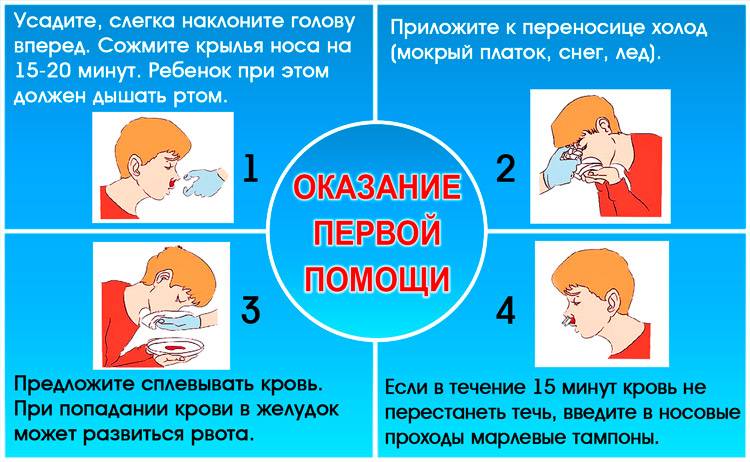 Носовое кровотечение карта вызова