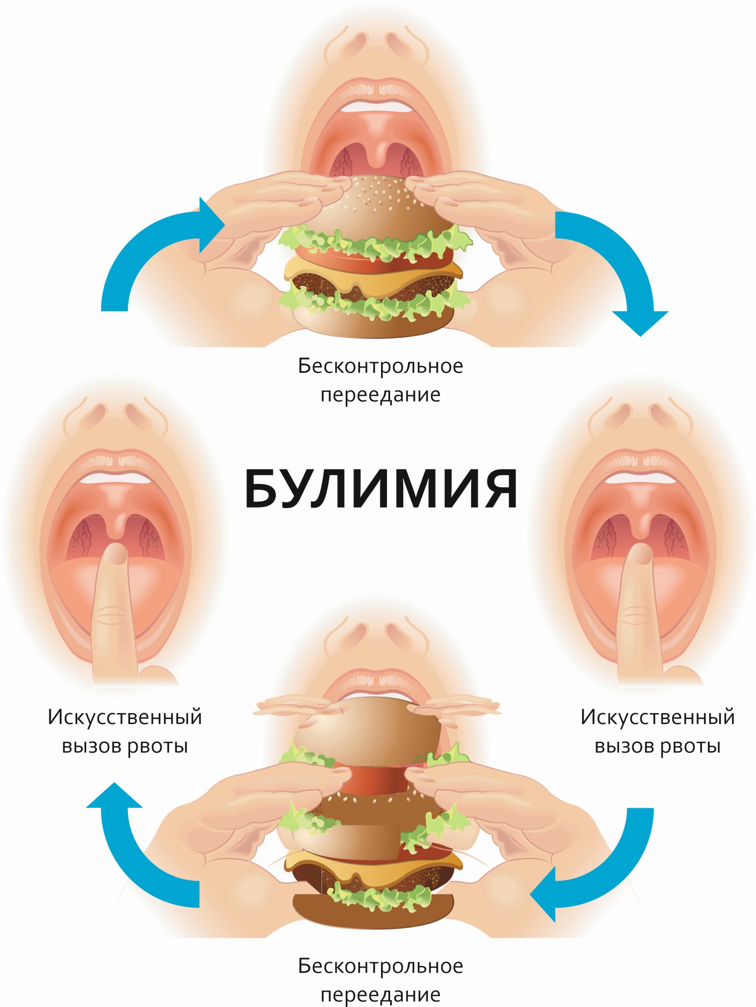 Нервное пищевое расстройство