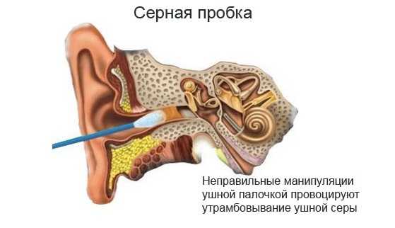 На фоне насморка заложило ухо что делать